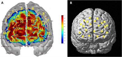 Functional Near-Infrared Spectroscopy Indicates That Asymmetric Right Hemispheric Activation in Mental Rotation of a Jigsaw Puzzle Decreases With Task Difficulty